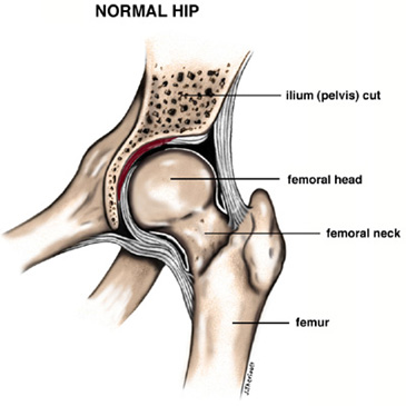 Diagram of a Normal Hip Joint